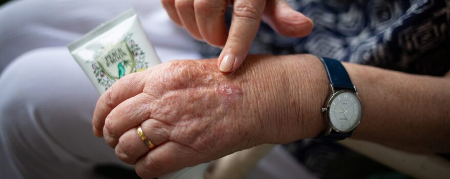 Elderly womans hands